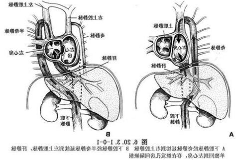 下腔靜脈 孕婦